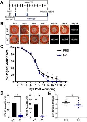 Nitric oxide-releasing gel accelerates healing in a diabetic murine splinted excisional wound model